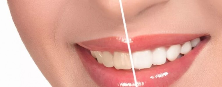 Как сохранить зубы белыми