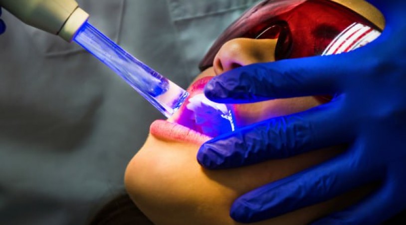 Сучасні тренди в стоматології: від лікування уві сні до 3D-технологій